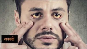 kavil symptoms in marathi
