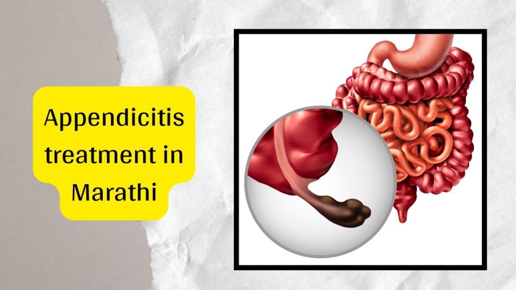 appendix-meaning-in-marathi-appendix-operation-in-marathi