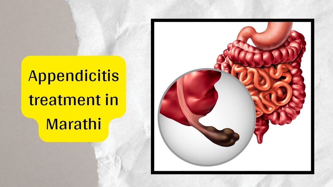 Appendicitis treatment in Marathi