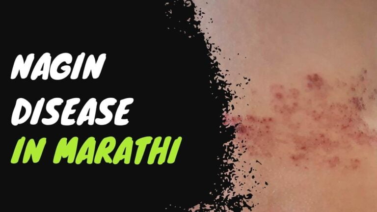 Nagin disease in Marathi