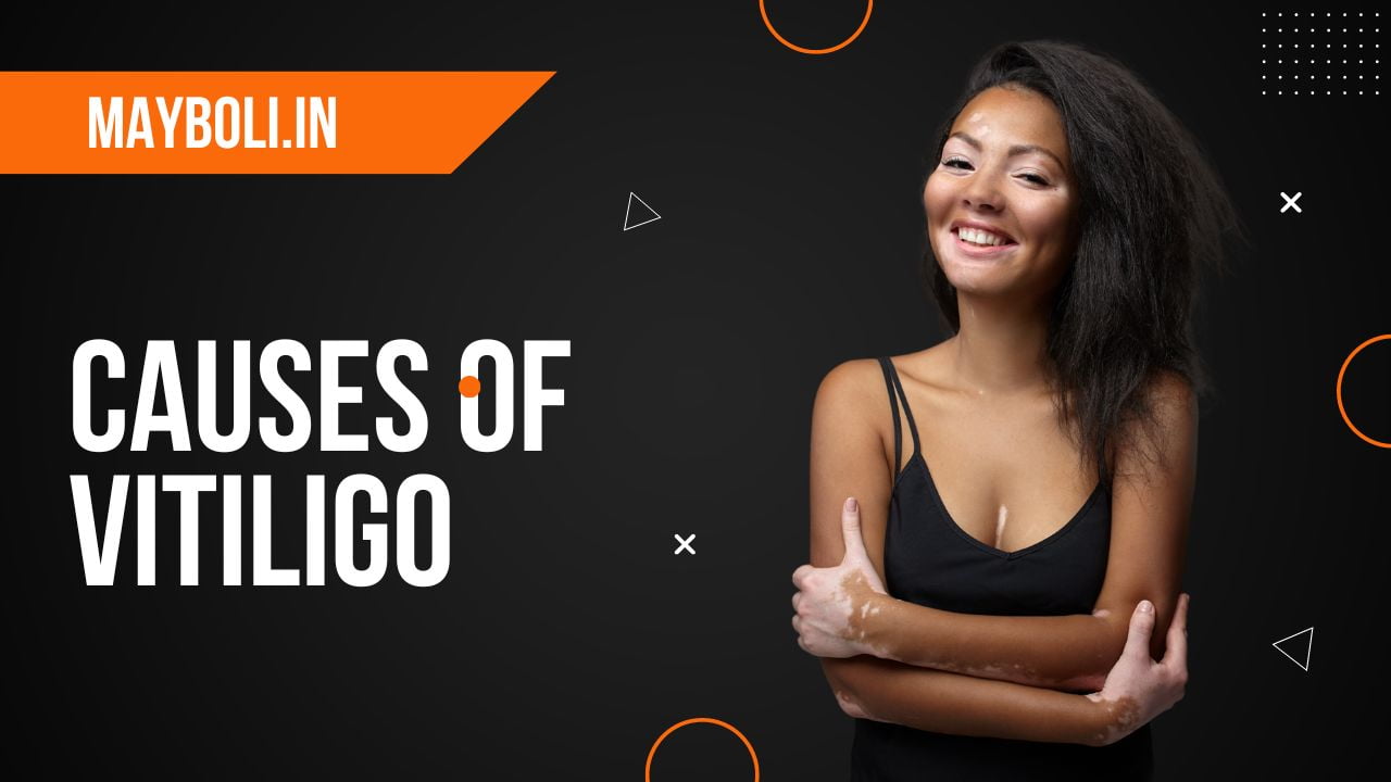 Causes of Vitiligo in Marathi