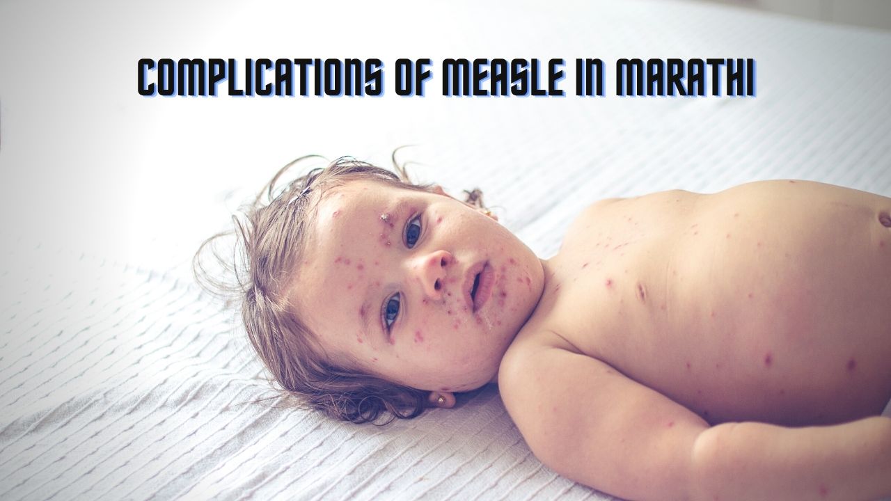 Complications of Measles in Marathi