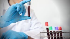 MCHC in Blood Test Meaning in Marathi