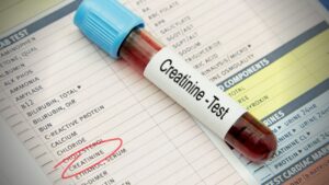 creatinine test means in marathi
