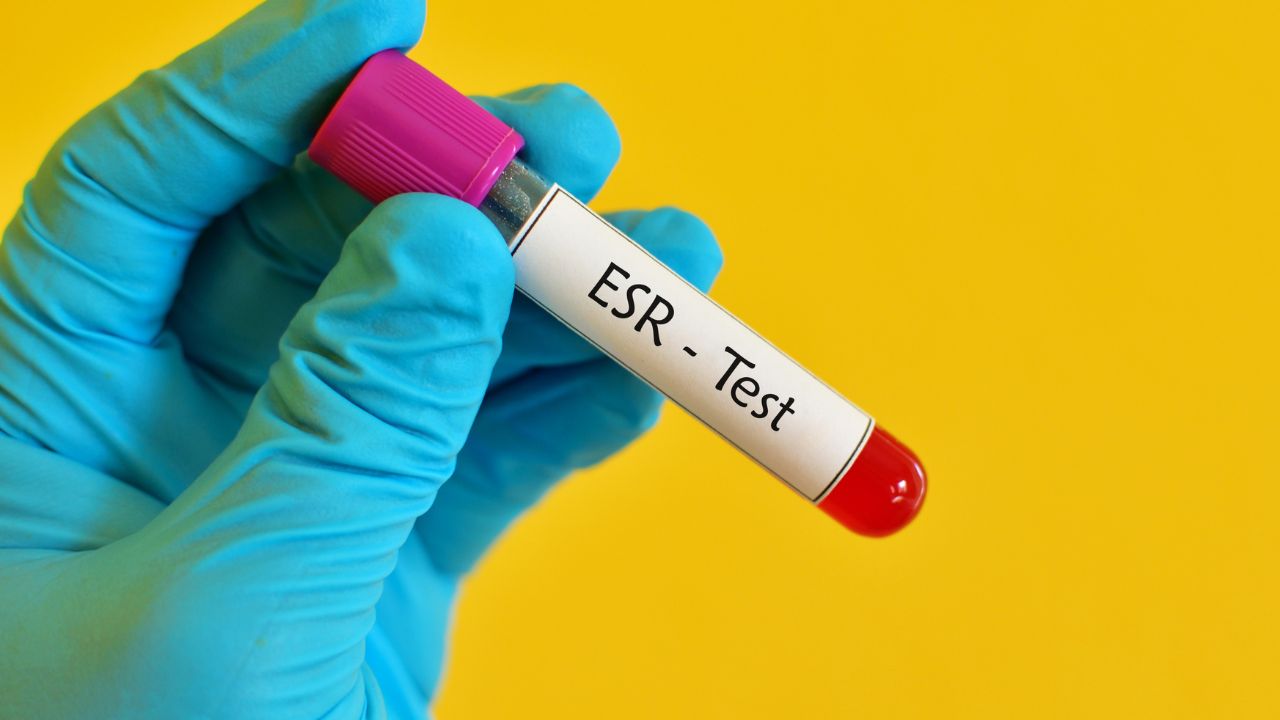 esr-test-in-marathi-mayboli-in