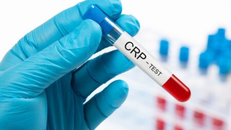crp test meaning in marathi