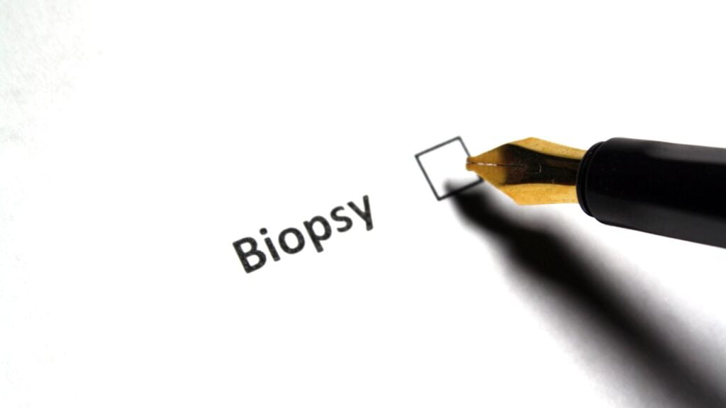 Biopsy Meaning in Marathi