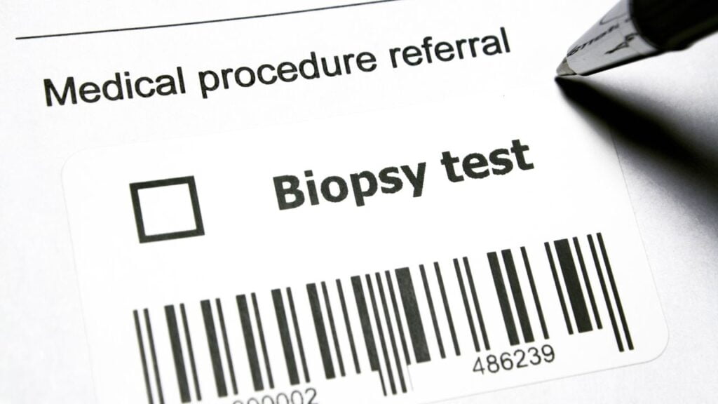 biopsy-meaning-in-marathi-mayboli-in