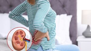 Kidney Stone Symptoms in Marathi