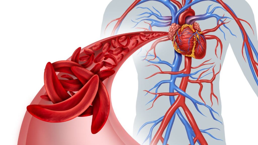 Heart Blockage Symptoms in Marathi